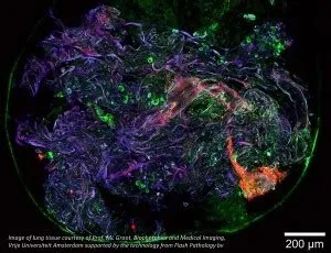  Quantum Dots: Valo teknologian huipulta nanomittaiseen ihmeeseen!